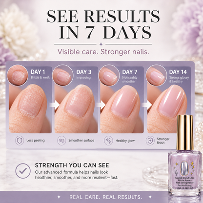🎉💅 40% OFF !! ⏰ Lilac Glossy Nail Strengthener – Strengthen Weak Nails & Restore Natural Shine — Devareon®